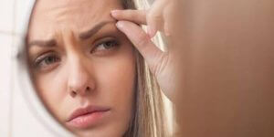 Göz Kapağı Şişliği Nasıl Giderilir?