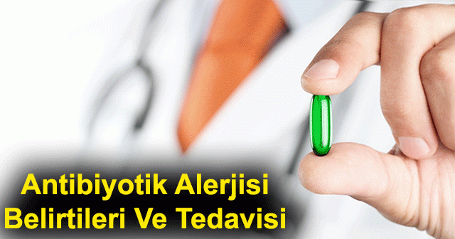 Antibiyotik Alerjisi Belirtileri ve Tedavisi