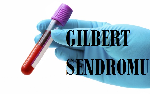 Gilbert Sendromu Nedir Belirtileri Nelerdir