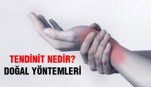 Tendinit Nedir? Tedavisi Nasıl Yapılır?