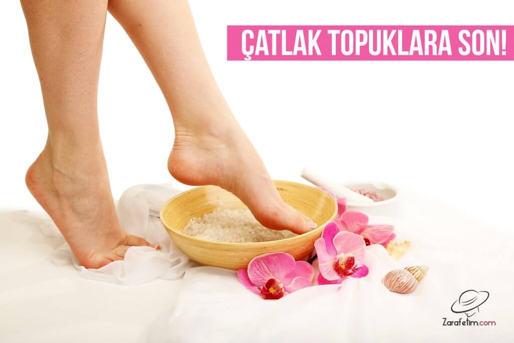 Topuk Çatlaklarına Ne İyi Gelir