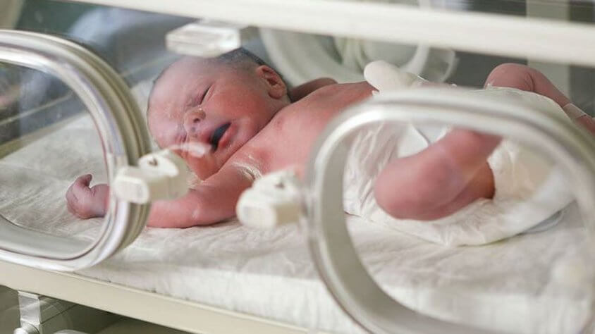 premature bebek nedir premature bebek sagligi gelisimi ve bakimi