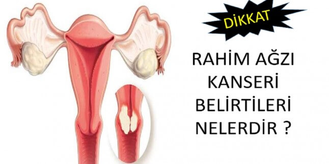 rahim ağzı kanseri belirtileri